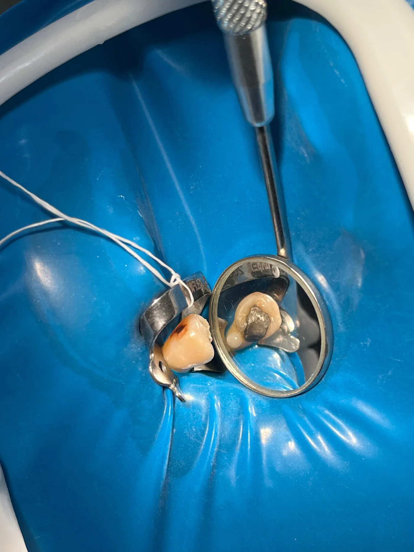 Condição inicial de dente posterior antes da restauração Classe II